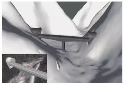 【BIM应用】BIM助力西成客专,天堑变通途 BIM视界 第12张-BIM建筑网 【BIM应用】BIM助力西成客专,天堑变通途 BIM视界 第12张